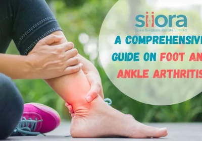 A Comprehensive Guide on Foot and Ankle Arthritis